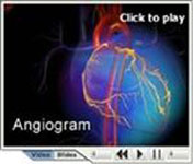 angiogram