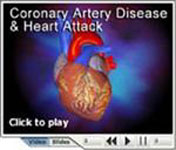 coronary